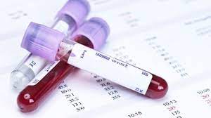 AVISO DE DISPENSA DE LICITAÃÃO nÂº011/2024 - EXAMES LABORATORIAIS